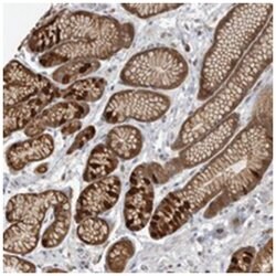 CCBL2 Rabbit anti-Human, Polyclonal Antibody, Abnova 100 &mu;L | Buy Online | Abnova Corporation | Fisher Scientific
