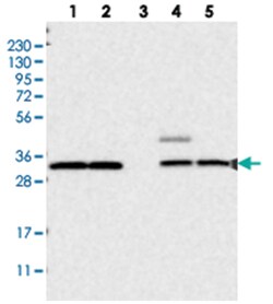 UBE3D, Rabbit, Polyclonal Antibody, Abnova 100 &mu;L | Buy Online | Abnova Corporation | Fisher Scientific