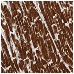 UBE3D, Rabbit, Polyclonal Antibody, Abnova 100 &mu;L | Buy Online | Abnova Corporation | Fisher Scientific