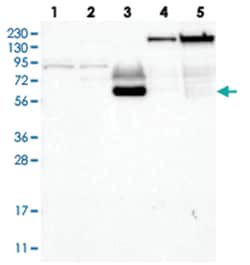 ECM1, Rabbit, Polyclonal Antibody, Abnova 100 &mu;L | Buy Online | Abnova Corporation | Fisher Scientific