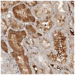 ECM1, Rabbit, Polyclonal Antibody, Abnova 100 &mu;L | Buy Online | Abnova Corporation | Fisher Scientific