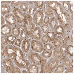 FLJ35848 Rabbit anti-Human, Polyclonal Antibody, Abnova 100 &mu;L | Buy Online | Abnova Corporation | Fisher Scientific