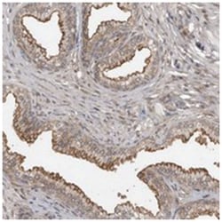 ABL1 Rabbit anti-Human, Polyclonal Antibody, Abnova 100 &mu;L | Buy Online | Abnova Corporation | Fisher Scientific