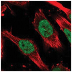 ABL1 Rabbit anti-Human, Polyclonal Antibody, Abnova 100 &mu;L | Buy Online | Abnova Corporation | Fisher Scientific