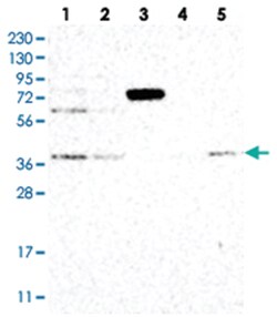 STRAP Rabbit anti-Human, Mouse, Rat, Polyclonal Antibody, Abnova 100&mu;L;