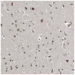 EVI5, Rabbit, Polyclonal Antibody, Abnova 100&mu;L; Unlabeled:Antibodies,