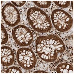 SNRNP40 Rabbit anti-Human, Polyclonal Antibody, Abnova 100&mu;L; Unlabeled:Antibodies,