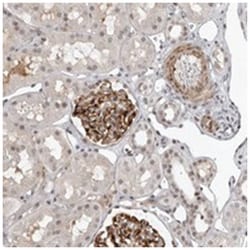 TRIM66, Rabbit, Polyclonal Antibody, Abnova 100 &mu;L | Buy Online | Abnova | Fisher Scientific