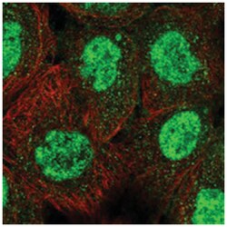 TRIM66, Rabbit, Polyclonal Antibody, Abnova 100 &mu;L | Buy Online | Abnova | Fisher Scientific