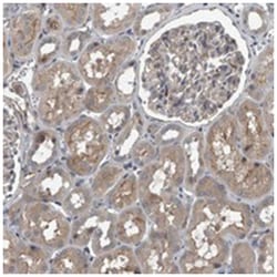 EXOC8, Rabbit, Polyclonal Antibody, Abnova 100 &mu;L | Buy Online | Abnova Corporation | Fisher Scientific