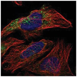 EXOC8, Rabbit, Polyclonal Antibody, Abnova 100 &mu;L | Buy Online | Abnova Corporation | Fisher Scientific
