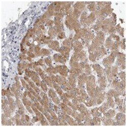 PRSS38, Rabbit, Polyclonal Antibody, Abnova 100 &mu;L | Buy Online | Abnova Corporation | Fisher Scientific