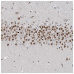 C8orf58 Rabbit anti-Human, Polyclonal Antibody, Abnova 100 &mu;L | Buy Online | Abnova Corporation | Fisher Scientific