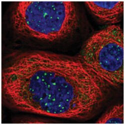 C8orf58 Rabbit anti-Human, Polyclonal Antibody, Abnova 100 &mu;L | Buy Online | Abnova Corporation | Fisher Scientific