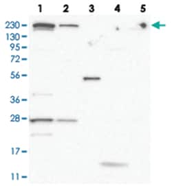 ZFHX2 Rabbit anti-Human, Polyclonal Antibody, Abnova 100 &mu;L | Buy Online | Abnova Corporation | Fisher Scientific