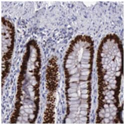 SATB2 Rabbit anti-Human, Polyclonal Antibody, Abnova 100 &mu;L | Buy Online | Abnova Corporation | Fisher Scientific