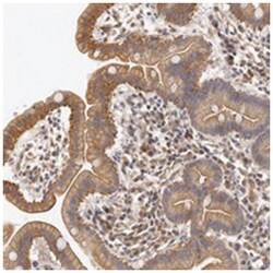 CHST7, Rabbit, Polyclonal Antibody, Abnova 100&mu;L; Unlabeled:Antibodies,