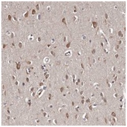 TNRC4, Rabbit, Polyclonal Antibody, Abnova 100&mu;L; Unlabeled:Antibodies,