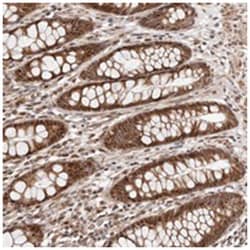 HIVEP3, Rabbit, Polyclonal Antibody, Abnova 100 &mu;L | Buy Online | Abnova Corporation | Fisher Scientific