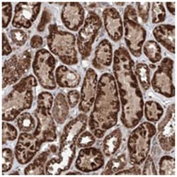 ZNF445, Rabbit, Polyclonal Antibody, Abnova 100 &mu;L | Buy Online | Abnova Corporation | Fisher Scientific