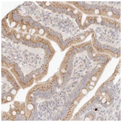 FAM20B, Rabbit, Polyclonal Antibody, Abnova 100 &mu;L | Buy Online | Abnova Corporation | Fisher Scientific