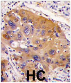 NNMT, Rabbit, Polyclonal Antibody, Abnova 400 &mu;L | Buy Online | Abnova Corporation | Fisher Scientific