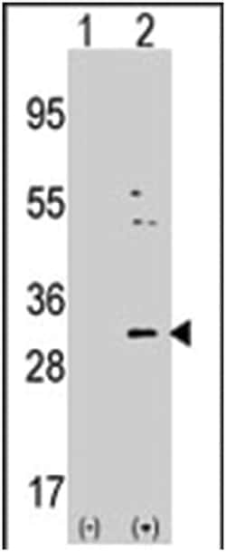 NNMT, Rabbit, Polyclonal Antibody, Abnova 400 &mu;L | Buy Online | Abnova Corporation | Fisher Scientific