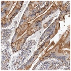 ABHD9, Rabbit, Polyclonal Antibody, Abnova 100 &mu;L | Buy Online | Abnova Corporation | Fisher Scientific