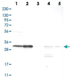SLC25A22, Rabbit, Polyclonal Antibody, Abnova 100 &mu;L | Buy Online | Abnova | Fisher Scientific