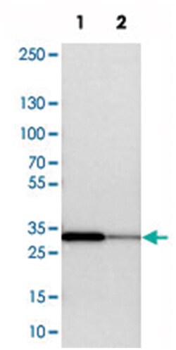 SLC25A22, Rabbit, Polyclonal Antibody, Abnova 100 &mu;L | Buy Online | Abnova | Fisher Scientific