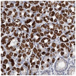 AQP6, Rabbit, Polyclonal Antibody, Abnova 100&mu;L; Unlabeled:Antibodies,