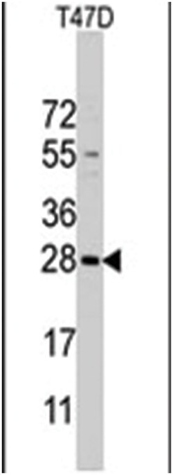 PEMT, Rabbit, Polyclonal Antibody, Abnova 400μL; Unlabeled:Antibodies,