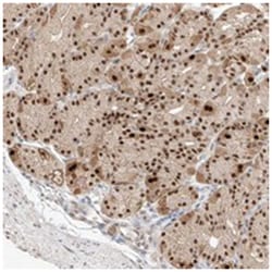 APIP Rabbit anti-Human, Polyclonal Antibody, Abnova 100&mu;L; Unlabeled:Antibodies,