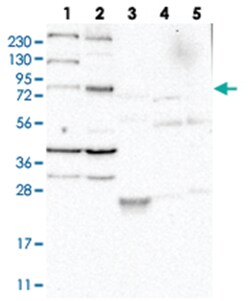 LOC389813, Rabbit, Polyclonal Antibody, Abnova 100 &mu;L | Buy Online | Abnova Corporation | Fisher Scientific