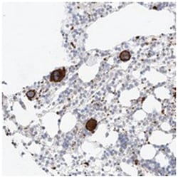 LOC389813, Rabbit, Polyclonal Antibody, Abnova 100 &mu;L | Buy Online | Abnova Corporation | Fisher Scientific