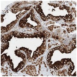 LOC201229, Rabbit, Polyclonal Antibody, Abnova 100&mu;L; Unlabeled:Antibodies,