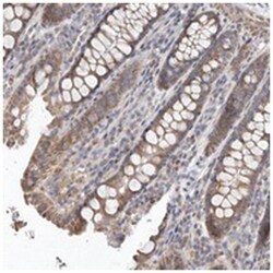 UNK Rabbit anti-Human, Polyclonal Antibody, Abnova 100&mu;L; Unlabeled:Antibodies,