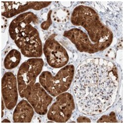 APIP Rabbit anti-Human, Polyclonal Antibody, Abnova 100 &mu;L | Buy Online | Abnova Corporation | Fisher Scientific