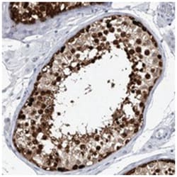 LURAP1L, Rabbit, Polyclonal Antibody, Abnova 100&mu;L; Unlabeled:Antibodies,