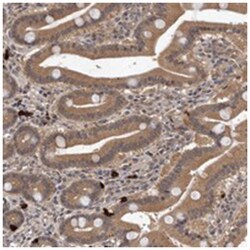 VPS37A Rabbit anti-Human, Polyclonal Antibody, Abnova 100 &mu;L | Buy Online | Abnova Corporation | Fisher Scientific