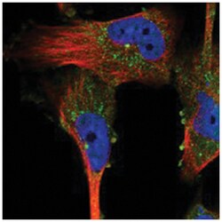 VPS37A Rabbit anti-Human, Polyclonal Antibody, Abnova 100 &mu;L | Buy Online | Abnova Corporation | Fisher Scientific