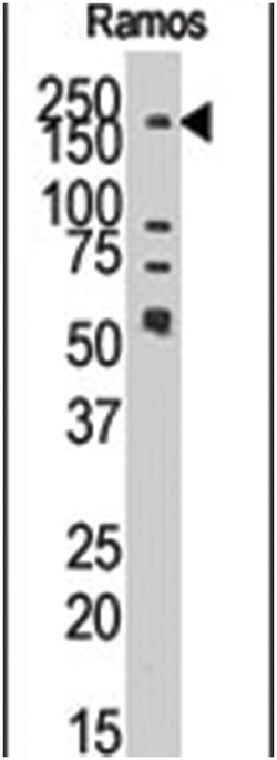 JMJD1B (KDM3B) Rabbit anti-Human, Polyclonal Antibody, Abnova 400 &mu;L | Buy Online | Abnova Corporation | Fisher Scientific