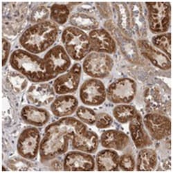 VPS37A Rabbit anti-Human, Polyclonal Antibody, Abnova 100 &mu;L | Buy Online | Abnova Corporation | Fisher Scientific