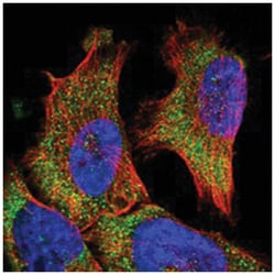 VPS37A Rabbit anti-Human, Polyclonal Antibody, Abnova 100 &mu;L | Buy Online | Abnova Corporation | Fisher Scientific