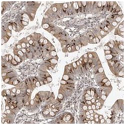 SMG8, Rabbit, Polyclonal Antibody, Abnova 100 &mu;L | Buy Online | Abnova Corporation | Fisher Scientific