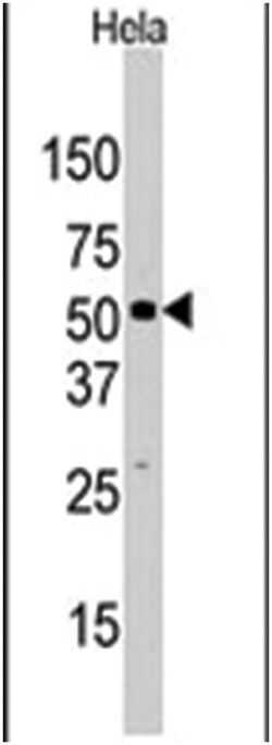 JMJD2D Rabbit anti-Human, Polyclonal Antibody, Abnova 400&mu;L; Unlabeled:Antibodies,