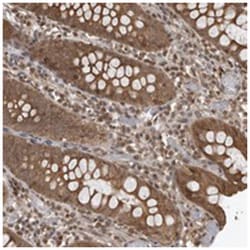 DNAJC8, Rabbit, Polyclonal Antibody, Abnova 100&mu;L; Unlabeled:Antibodies,