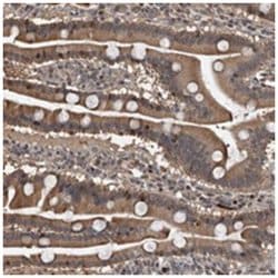 RAD54B, Rabbit, Polyclonal Antibody, Abnova 100 &mu;L | Buy Online | Abnova Corporation | Fisher Scientific