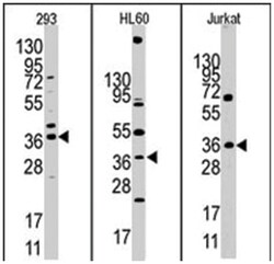 HIF1AN Rabbit anti-Human, Polyclonal Antibody, Abnova 400&mu;L; Unlabeled:Antibodies,