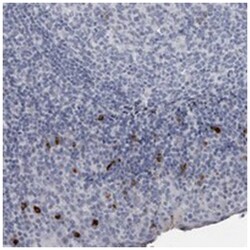 SLC25A39, Rabbit, Polyclonal Antibody, Abnova 100&mu;L; Unlabeled:Antibodies,